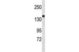Integrin alpha 2 antibody western blot analysis in mouse kidney tissue lysate (ITGA2 抗体  (AA 1152-1180))