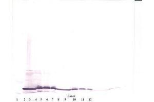 Image no. 2 for anti-Interleukin 17F (IL17F) antibody (ABIN465701) (IL17F 抗体)