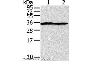 Western blot analysis of A375 cell, using STX3 Polyclonal Antibody at dilution of 1:400 (STX3 抗体)