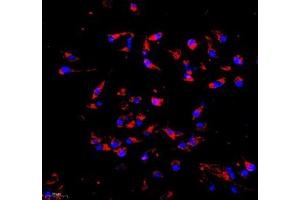 Immunocytochemistry analysis of 4 % paraformaldehyde-fixed HeLa cells using COX5B (ABIN7073665) at dilution of 1: 1000 (200x lens) (COX5B 抗体)