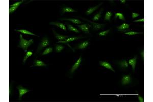 Immunofluorescence of purified MaxPab antibody to DUSP12 on HeLa cell. (DUSP12 抗体  (AA 1-340))