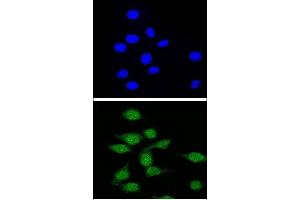Confocal immunofluorescent analysis of AIRE Antibody (Center) (ABIN655031 and ABIN2844662) with 293 cell followed by Alexa Fluor® 488-conjugated goat anti-rabbit lgG (green). (AIRE 抗体  (AA 64-92))