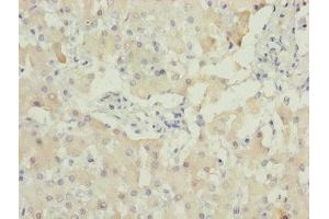 Immunohistochemistry of paraffin-embedded human liver tissue using ABIN7142330 at dilution of 1:100 (AKR1D1 抗体  (AA 1-200))