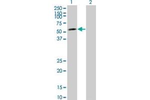 Western Blot analysis of LEF1 expression in transfected 293T cell line by LEF1 monoclonal antibody (M08), clone 2E2. (LEF1 抗体  (AA 33-138))
