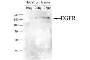 Image no. 1 for anti-Epidermal Growth Factor Receptor (EGFR) (AA 424-605) antibody (ABIN782452)