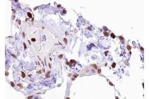 Immunohistochemistry (IHC) image for anti-ELK1, Member of ETS Oncogene Family (ELK1) (pSer383) antibody (ABIN6256307)