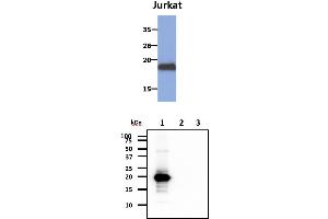 The cell lysates of Jurkat (30ug) were resolved by SDS-PAGE, transferred to PVDF membrane and probed with anti-human MAFK antibody (1:1000). (MAFK 抗体)