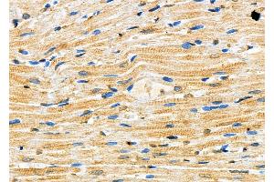 ABIN6257178 and ABIN6273623 at 1/100 staining Rat heart tissue by IHC-P. (FGF12 抗体  (C-Term))