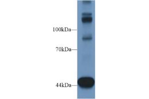 Western Blot; Sample: Mouse Heart lysate; Primary Ab: 1µg/ml Rabbit Anti-Human TNS1 Antibody Second Ab: 0. (Tensin 1 抗体  (AA 4-307))