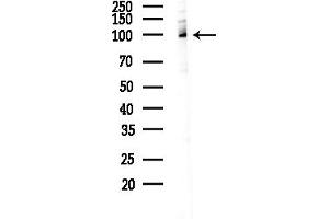 Western blot analysis of lysates from COLO205 cells(UV,30 min treatment), using GC2 Antibody at 1/1000 dilution.