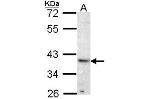 Western Blotting (WB) image for anti-ATPase, H+ Transporting, Lysosomal Accessory Protein 2 (ATP6AP2) (AA 146-320) antibody (ABIN467627)