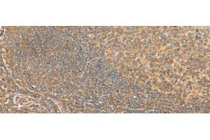 Immunohistochemistry (Paraffin-embedded Sections) (IHC (p)) image for anti-Ras-Related C3 Botulinum Toxin Substrate 3 (Rho Family, Small GTP Binding Protein Rac3) (RAC3) antibody (ABIN7246505)