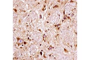FGFR3 antibody immunohistochemistry analysis in formalin fixed and paraffin embedded mouse brain tissue. (FGFR3 抗体  (AA 468-495))