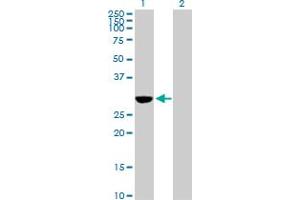 Western Blot analysis of NQO1 expression in transfected 293T cell line by NQO1 MaxPab polyclonal antibody. (NQO1 抗体  (AA 1-274))