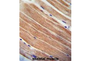 CST9 antibody (C-term) immunohistochemistry analysis in formalin fixed and paraffin embedded human skeletal muscle followed by peroxidase conjugation of the secondary antibody and DAB staining. (CST9 抗体  (C-Term))