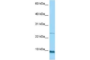 WB Suggested Anti-SPRR1A Antibody Titration: 1. (SPRR1A 抗体  (Middle Region))