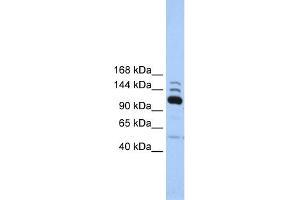 WB Suggested Anti-POLR3B Antibody Titration:  0. (POLR3B 抗体  (C-Term))