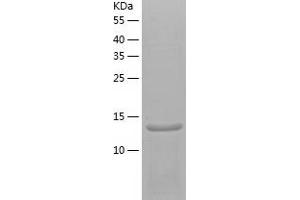 Western Blotting (WB) image for SH2 Domain Containing 1A (SH2D1A) (AA 1-128) protein (His tag) (ABIN7284554) (SH2D1A Protein (AA 1-128) (His tag))