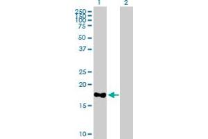 Western Blot analysis of MARCH2 expression in transfected 293T cell line by MARCH2 MaxPab polyclonal antibody. (MARCH2 抗体  (AA 1-176))
