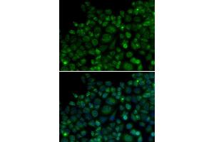 Immunofluorescence analysis of MCF7 cell using TLR7 antibody.