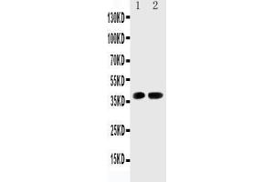 Anti-Cdk6 antibody, Western blotting Lane 1: Rat Testis Tissue Lysate Lane 2: Rat Lung Tissue Lysate (CDK6 抗体  (C-Term))