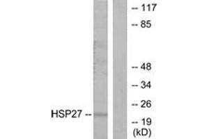 Western Blotting (WB) image for anti-Heat Shock 27kDa Protein 1 (HSPB1) (AA 5-54) antibody (ABIN2889005) (HSP27 抗体  (AA 5-54))