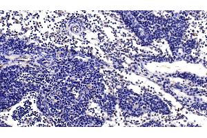 Detection of IFNa/bR1 in Rat Lymph node Tissue using Polyclonal Antibody to Interferon Alpha/Beta Receptor 1 (IFNa/bR1)