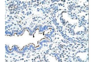 Image no. 1 for anti-Zinc Finger Protein 239 (ZNF239) (AA 160-209) antibody (ABIN6736298) (ZNF239 抗体  (AA 160-209))