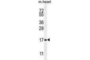Western blot analysis in mouse heart tissue lysates (35ug/lane) using SPACA5 Antibody . (SPACA5 抗体  (Middle Region))