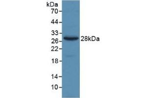 Detection of Recombinant a2M, Human using Monoclonal Antibody to Alpha-2-Macroglobulin (a2M) (alpha 2 Macroglobulin 抗体  (AA 616-856))