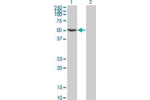 Western Blot analysis of FLI1 expression in transfected 293T cell line by FLI1 monoclonal antibody (M05), clone 1F6. (FLI1 抗体  (AA 1-452))