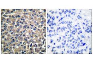 Immunohistochemistry (IHC) image for anti-Matrix Metallopeptidase 19 (MMP19) (N-Term) antibody (ABIN1848680) (MMP19 抗体  (N-Term))