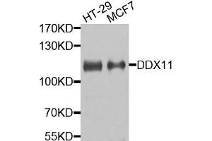 Western blot analysis of extracts of HT29 and MCF7 cells, using DDX11 antibody. (DDX11 抗体)