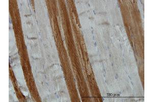 Immunoperoxidase of monoclonal antibody to TOM1 on formalin-fixed paraffin-embedded human skeletal muscle. (TOM1 抗体  (AA 394-491))