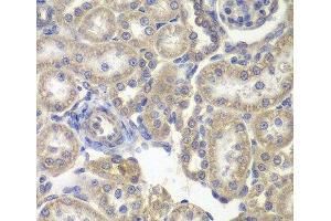 Immunohistochemistry of paraffin-embedded Rat kidney using H6PD Polyclonal Antibody at dilution of 1:200 (40x lens). (Glucose-6-Phosphate Dehydrogenase 抗体)