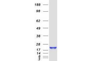 Western Blotting (WB) image for Ubiquitin-Conjugating Enzyme E2C (UBE2C) (Transcript Variant 1) protein (Myc-DYKDDDDK Tag) (ABIN2734785)