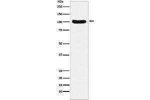 Western blot analysis of Cellular Apoptosis Susceptibility expression in Ramos cell lysate. (Recombinant Exportin 2 抗体)
