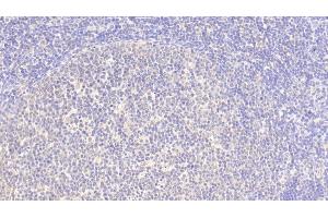 Detection of SRGN in Human Lymph node Tissue using Polyclonal Antibody to Serglycin (SRGN) (SRGN 抗体  (AA 28-158))
