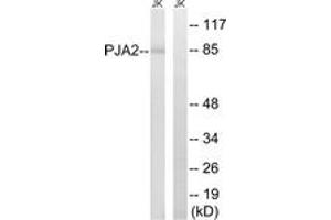 Western blot analysis of extracts from Jurkat cells, using PJA2 Antibody. (PJA2 抗体  (AA 141-190))