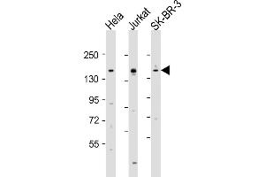 All lanes : Anti-FANCD2 Antibody (Center) at 1:2000 dilution Lane 1: Hela whole cell lysates Lane 2: Jurkat whole cell lysates Lane 3: SK-BR-3 whole cell lysates Lysates/proteins at 20 μg per lane. (FANCD2 抗体  (AA 893-927))