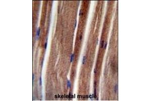 THUM3 Antibody (Center) (ABIN654774 and ABIN2844455) immunohistochemistry analysis in formalin fixed and paraffin embedded human skeletal muscle followed by peroxidase conjugation of the secondary antibody and DAB staining.