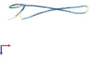 TCHP Protein (AA 1-497) (His tag)