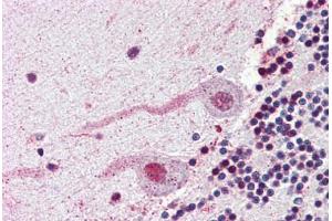 Brain, cerebellum, Human: Formalin-Fixed, Paraffin-Embedded (FFPE) (NEK7 抗体  (N-Term))