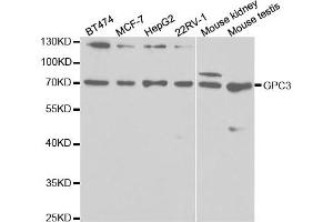 Western Blotting (WB) image for anti-Glypican 3 (GPC3) antibody (ABIN1875422) (Glypican 3 抗体)