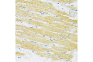 Immunohistochemistry of paraffin-embedded rat heart using TYROBP antibody (ABIN1876573) at dilution of 1:100 (40x lens). (TYROBP 抗体)