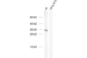 dilution: 1 : 1000, sample: brain homogenate from wildtype and Vti1a K. (VTI1A 抗体  (AA 2-185))