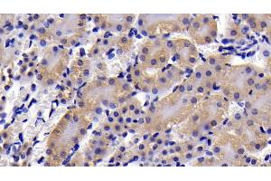 Detection of CASP3 in Mouse Kidney Tissue using Polyclonal Antibody to Caspase 3 (CASP3) (Caspase 3 抗体  (AA 29-175))