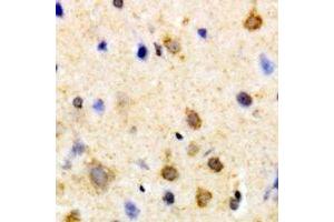Immunohistochemical analysis of PSKH1 staining in human brain formalin fixed paraffin embedded tissue section. (PSKH1 抗体)