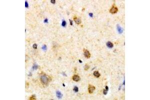 Immunohistochemical analysis of PSKH1 staining in human brain formalin fixed paraffin embedded tissue section. (PSKH1 抗体)