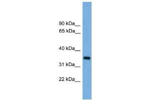 WB Suggested Anti-PRSS3 Antibody Titration: 0. (PRSS3 抗体  (N-Term))